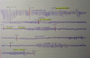 Representación de la radio